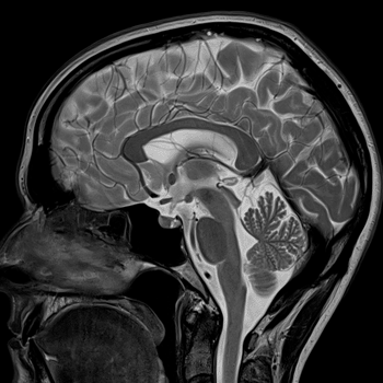 Image: A scan taken with the Magnetom Spectra MRI system (Photo courtesy of Siemens Healthcare).